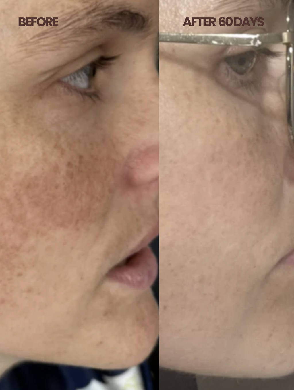 CLARENTINE  Natural Bakuchiol Retinol Alternative Oil Serum