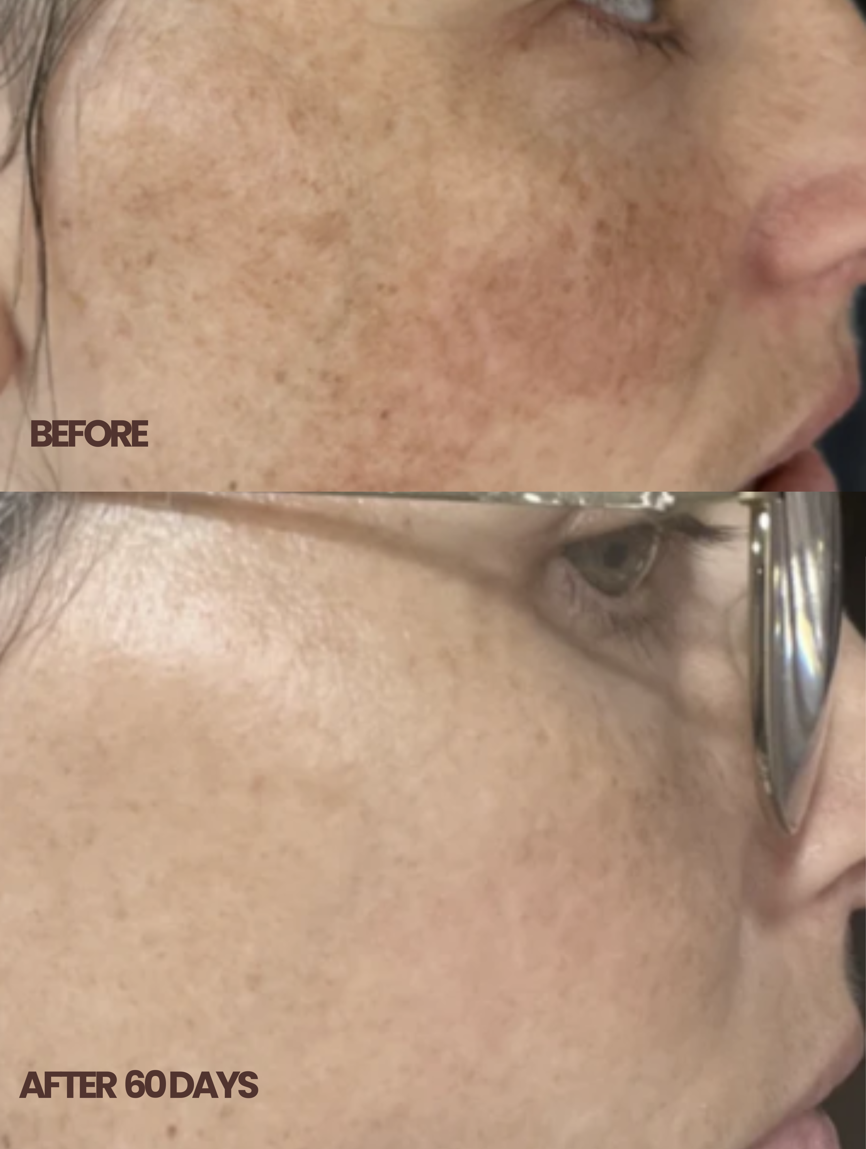 CLARENTINE  Natural Bakuchiol Retinol Alternative Oil Serum